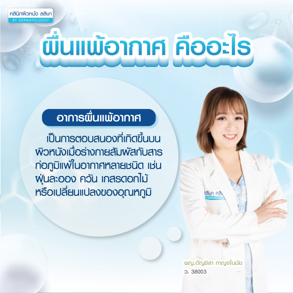 ผื่นแพ้อากาศ คือ