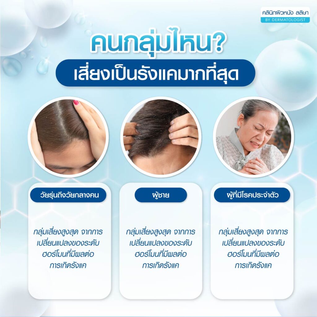 ผู้ที่เสี่ยงเป็ํนรังแค