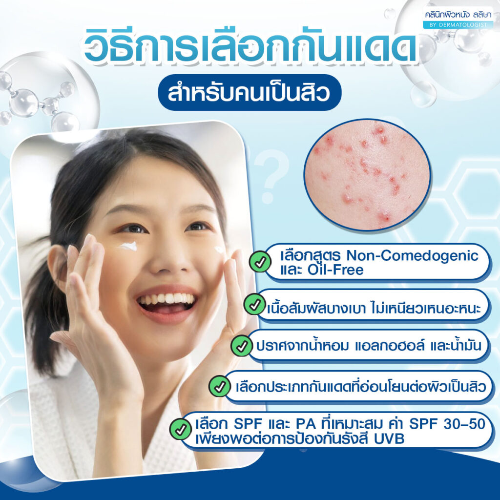 ภาพการเลือกกันแดดสำหรับคนเป็นสิว