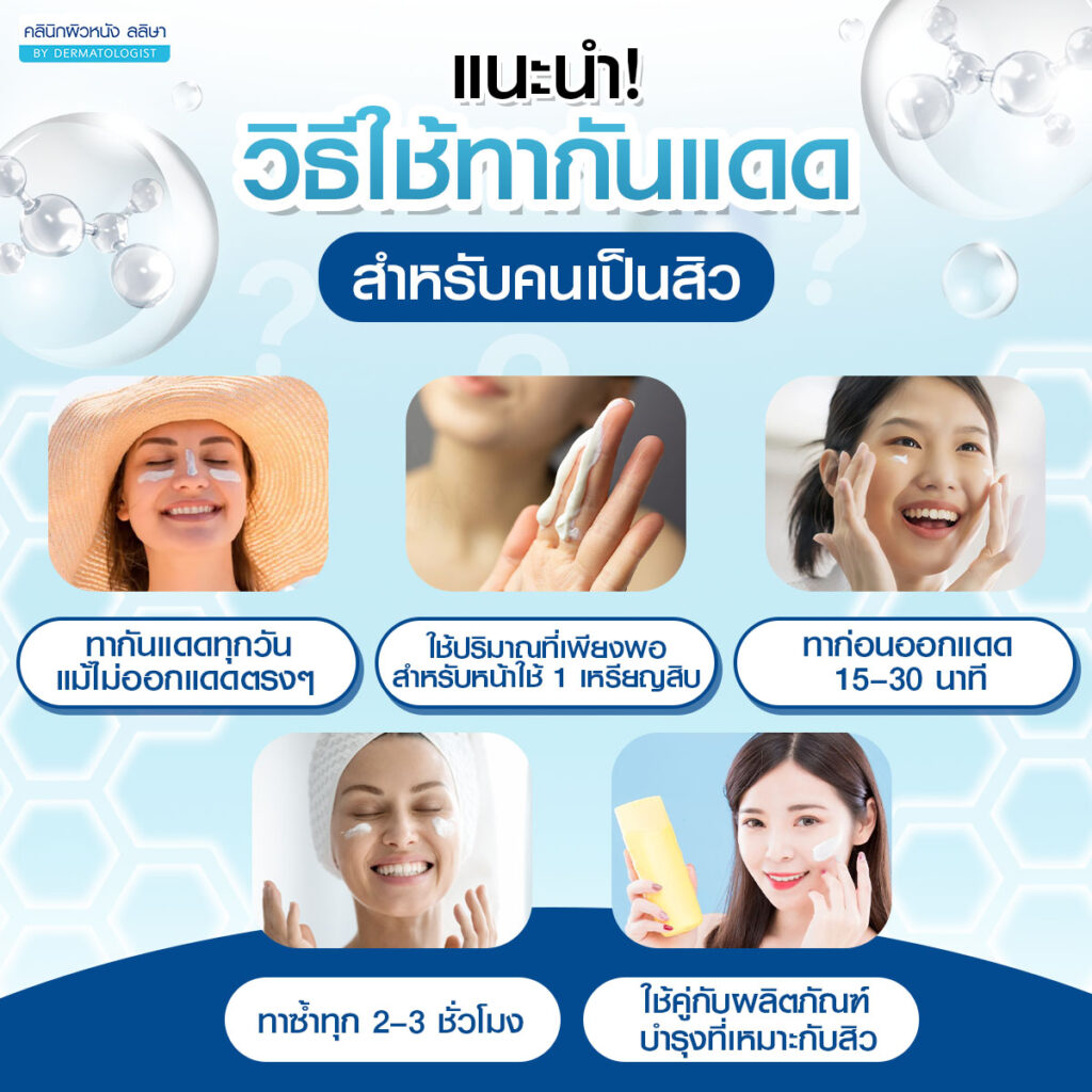 วิธีใช้ทากันแดดสำหรับคนเป็นสิว