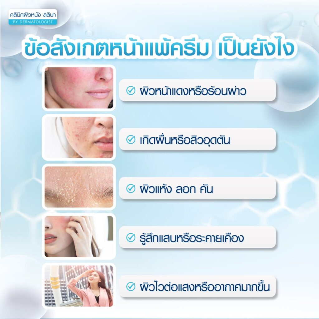 อากาสังเกตหน้าแพ้ครีม