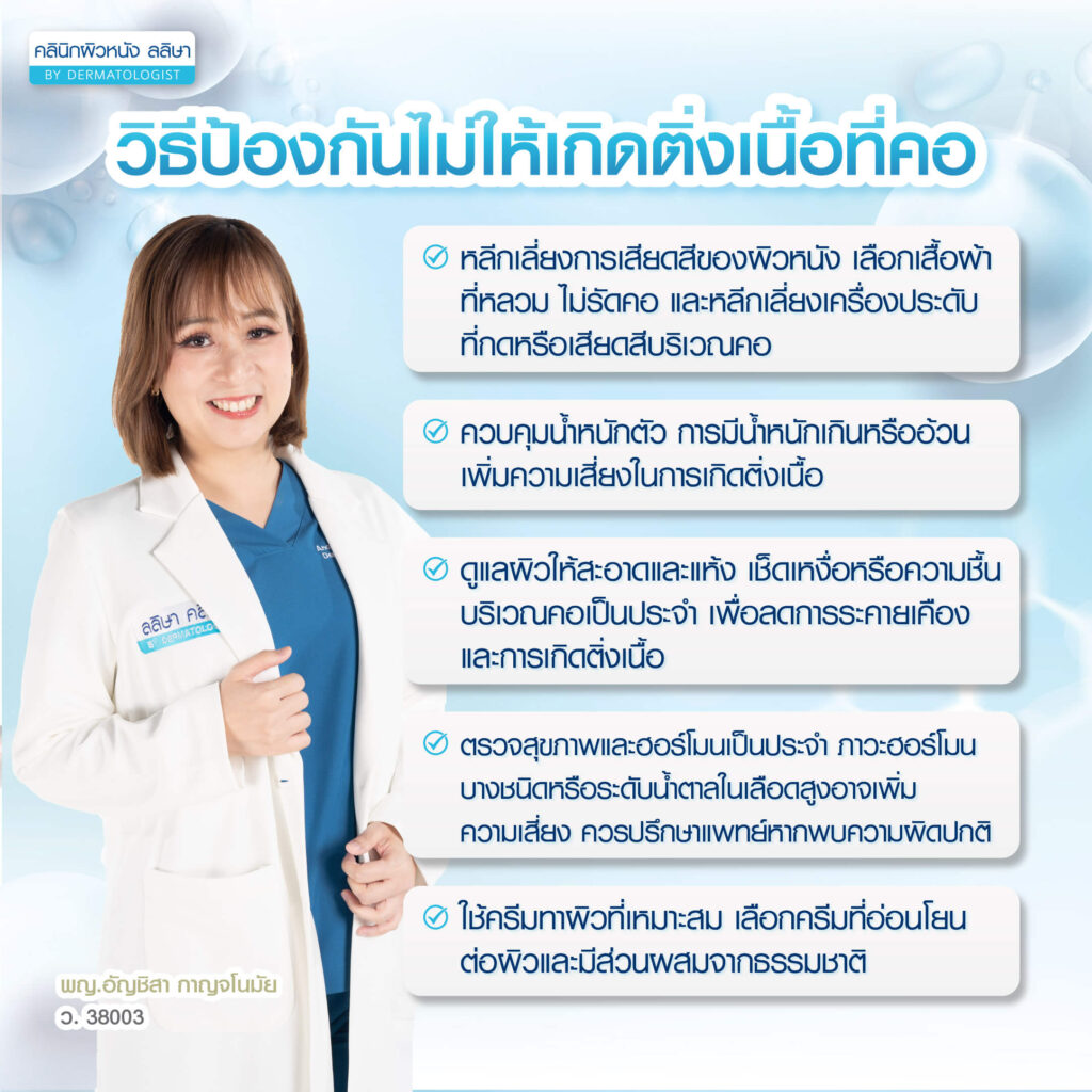 การป้องกันติ่งเนื้อที่คอ