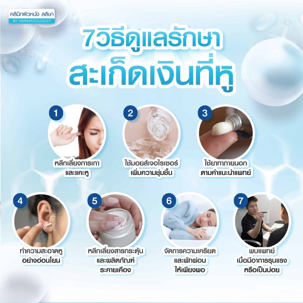 การแก้ปัญหาสะเก็ดเงินที่หู