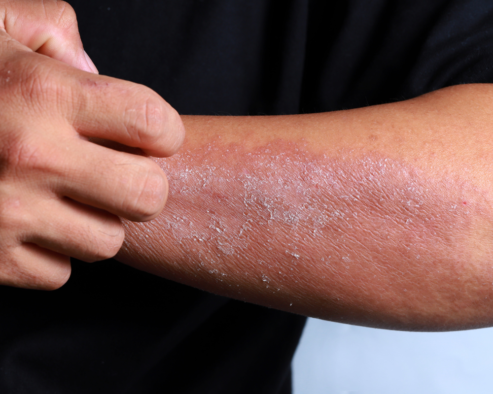 คันผิวหนัง