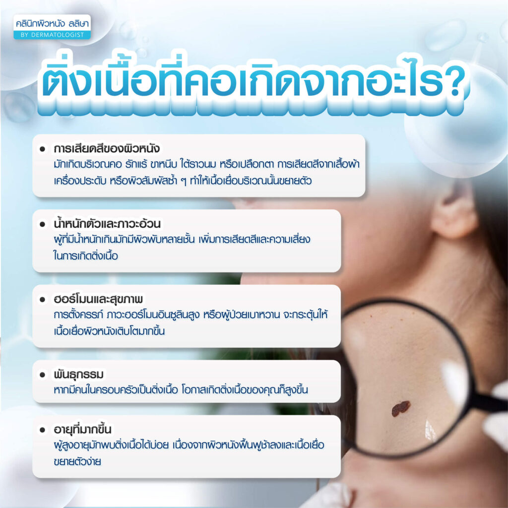 ติ่งเนื้อที่คอเกิดจากอะไร