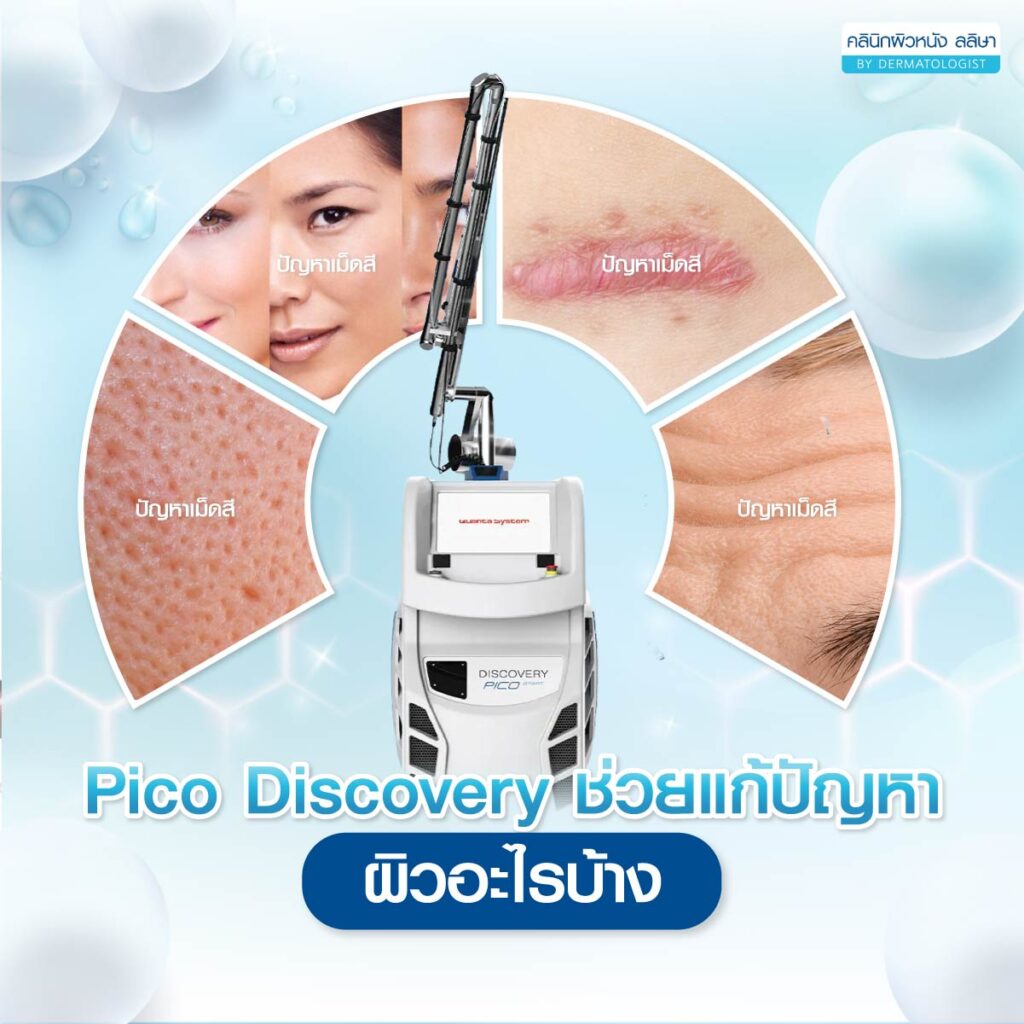 ปัญหาผิวที่เหมาะกับDiscovery Pico Laser