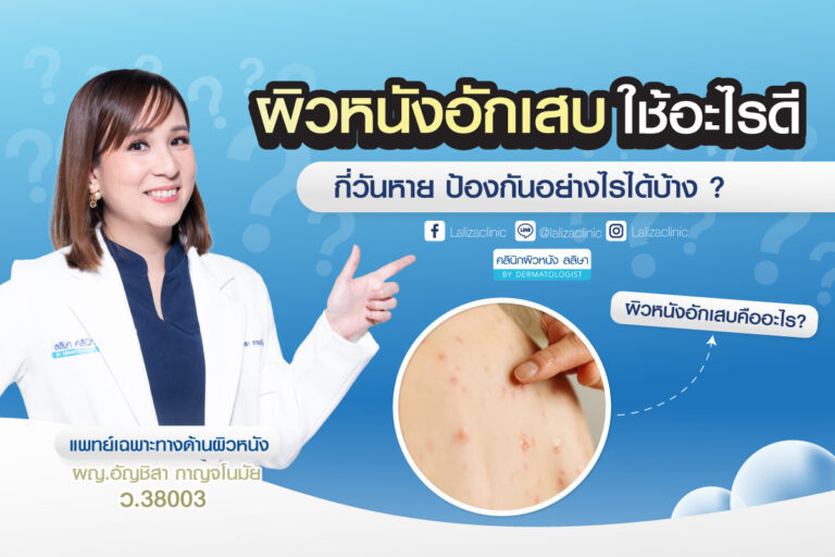 ผิวหนังอักเสบ ทำไมหายยาก สาเหตุและการดูแล