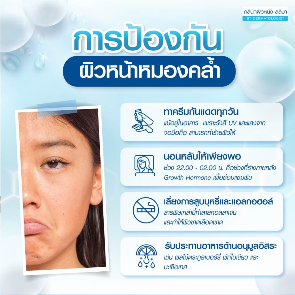 การป้องกันหน้าหมองคล้ำ