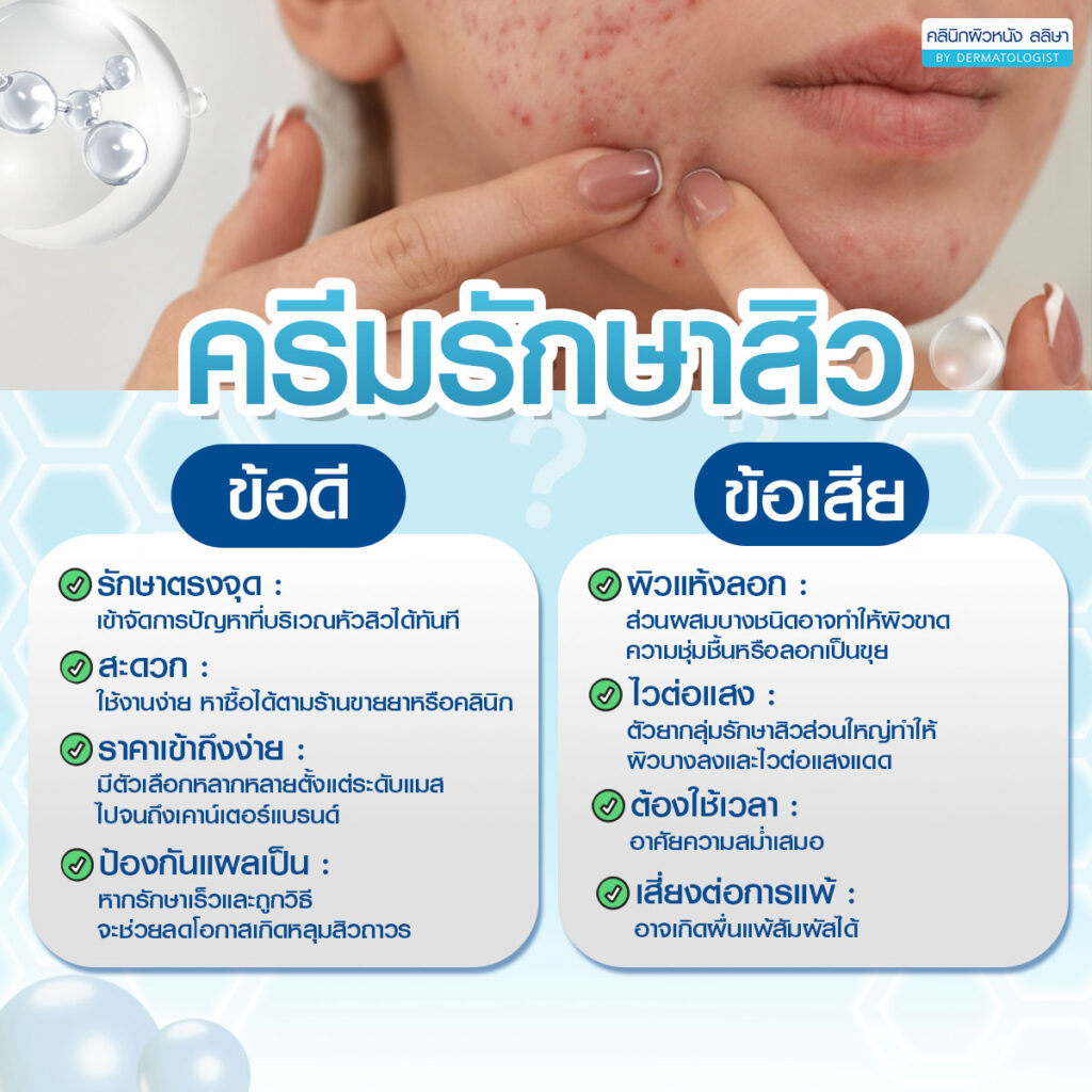 ข้อดี ข้อเสีย ครีมรักษาสิว