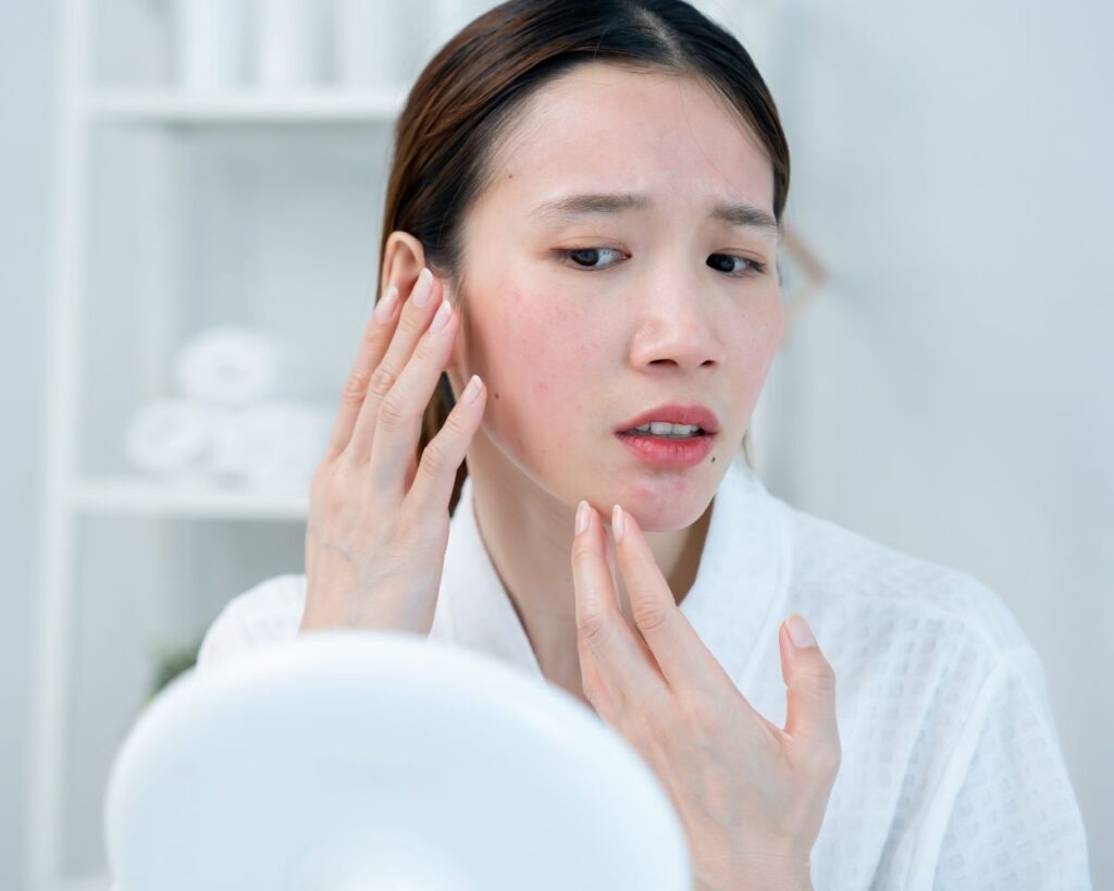 ครีมรักษาสิว ใช้กับสิวชนิดไหน