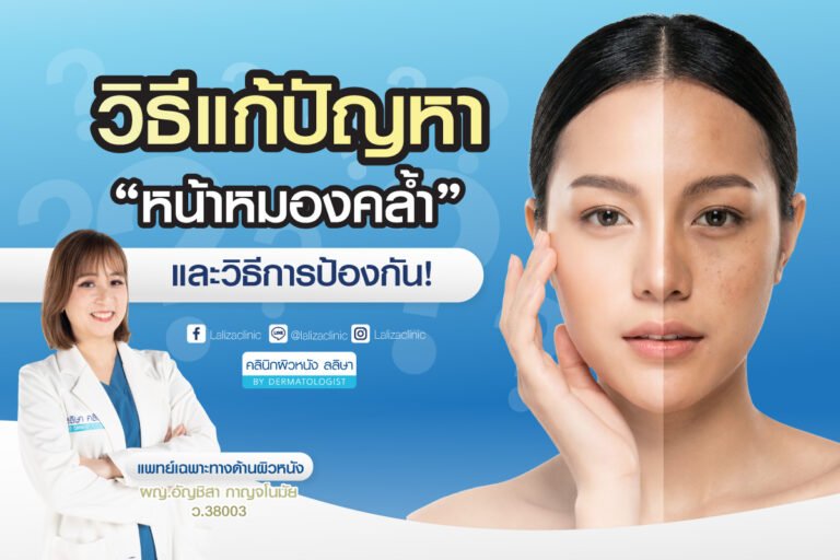 วิธีแก้ปัญหาหน้าหมองคล้ำ และการป้องกัน