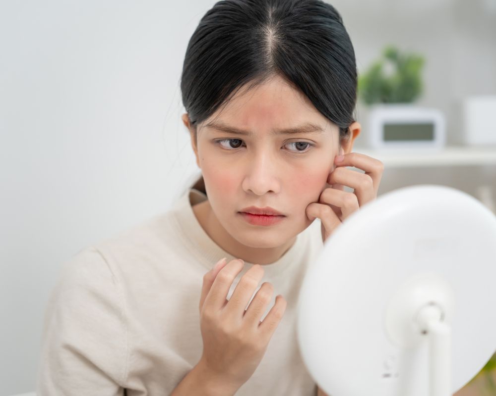 สิ่งที่ควรรู้ก่อนใช้ครีมลดสิว แต้มสิว รักษาสิว