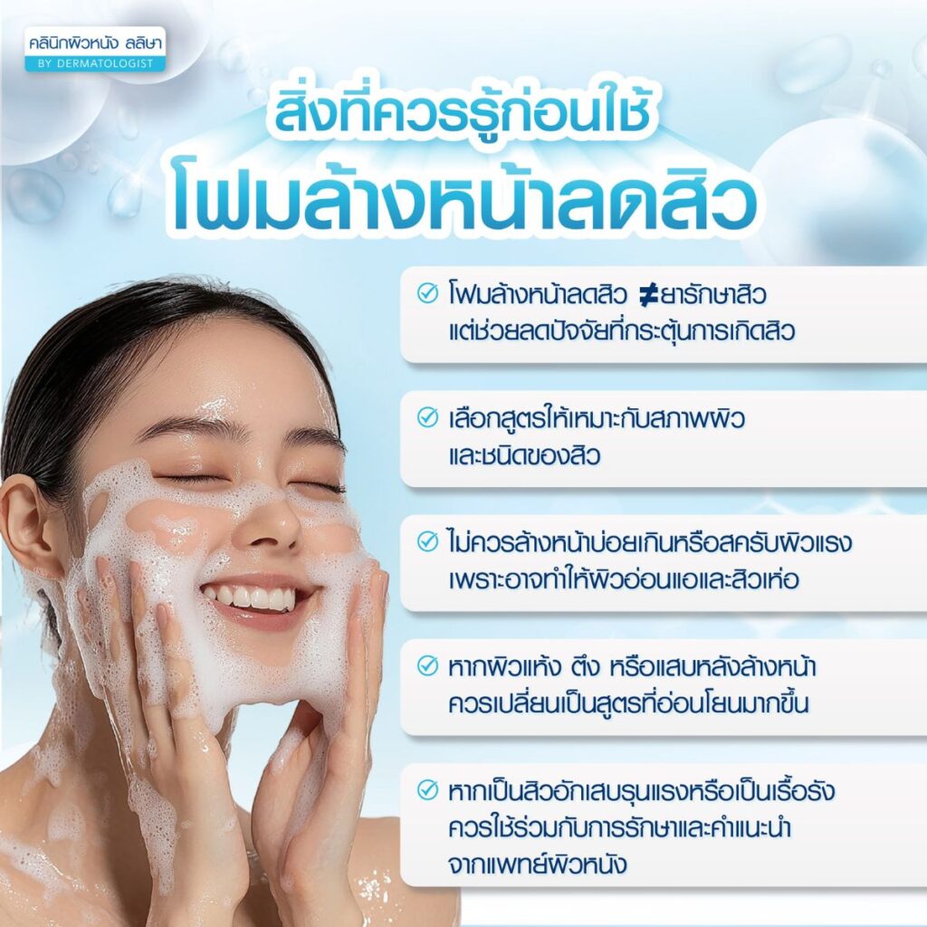 สิ่วที่ควรรู้ก่อนใช้