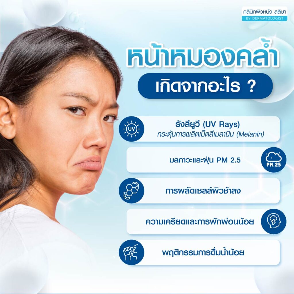 หน้าหมองคล้ำ เกิดจาก