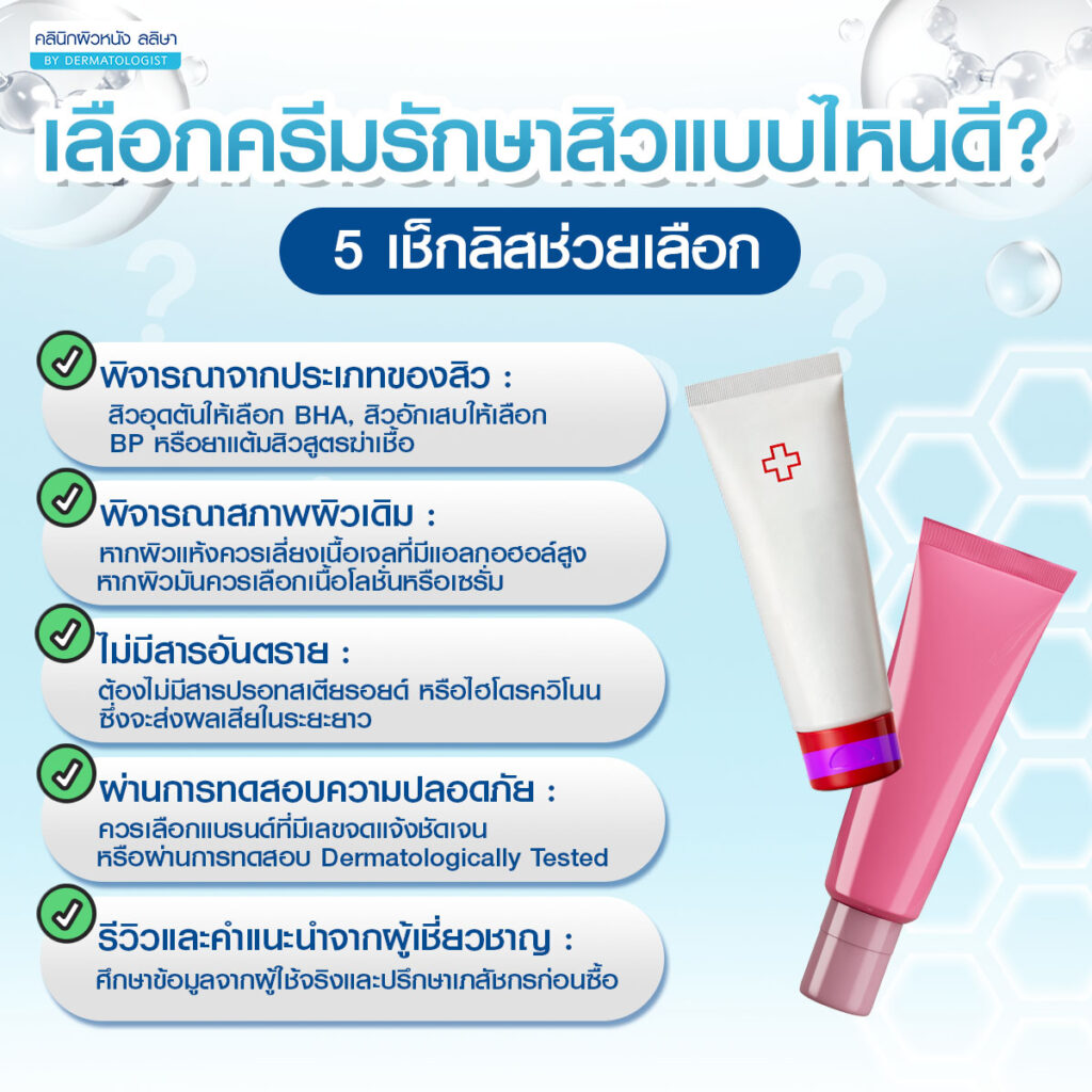 เลือกครีมรักษาสิวแบบไหนดี 5 เช็กลิสช่วยเลือก