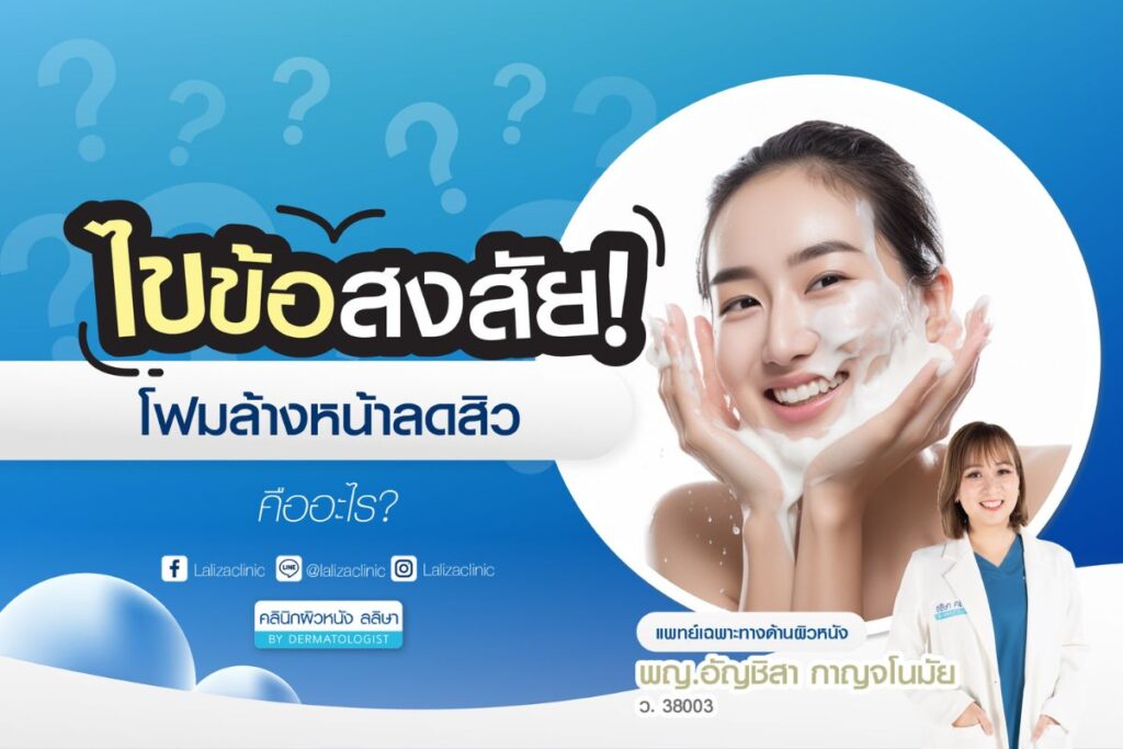 โฟมล้างหน้าลดสิว คืออะไร ใช้ยังไง ใช้กับสิวประเภทไหนได้บ้าง