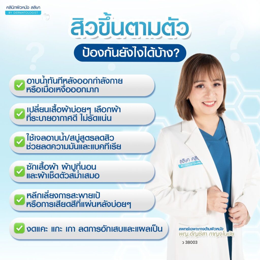 วิธีดูแลป้องกันไม่ให้สิวขึ้นตามตัว